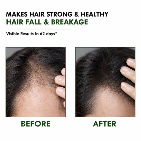 Rootwell Kesh Sanjeevani Hair Oil | Boost Hair Growth & Stop Hair Fall Naturally